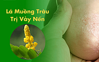 Có nên sử dụng cây muồng trâu trị vảy nến hay không?