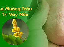 Có nên sử dụng cây muồng trâu trị vảy nến hay không?