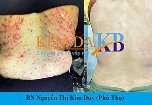 BN Nguyễn Thị Kim Duy (Phú Thọ)