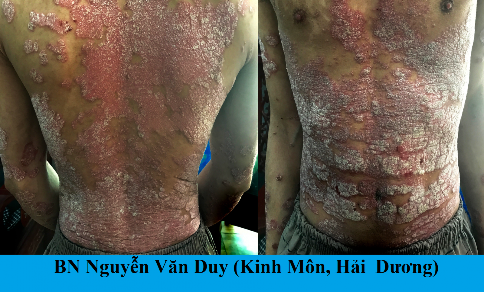 duy-hd-320-20copy-1